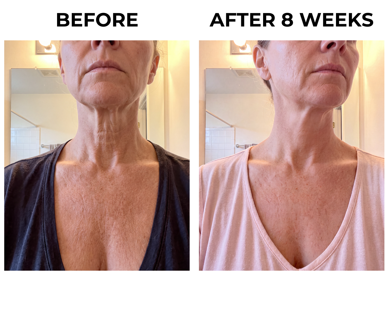 Neck and chest skin at week eight
