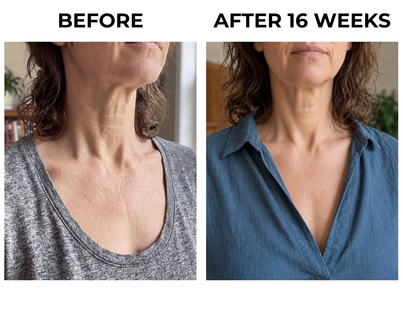 Neck and chest skin at week sixteen